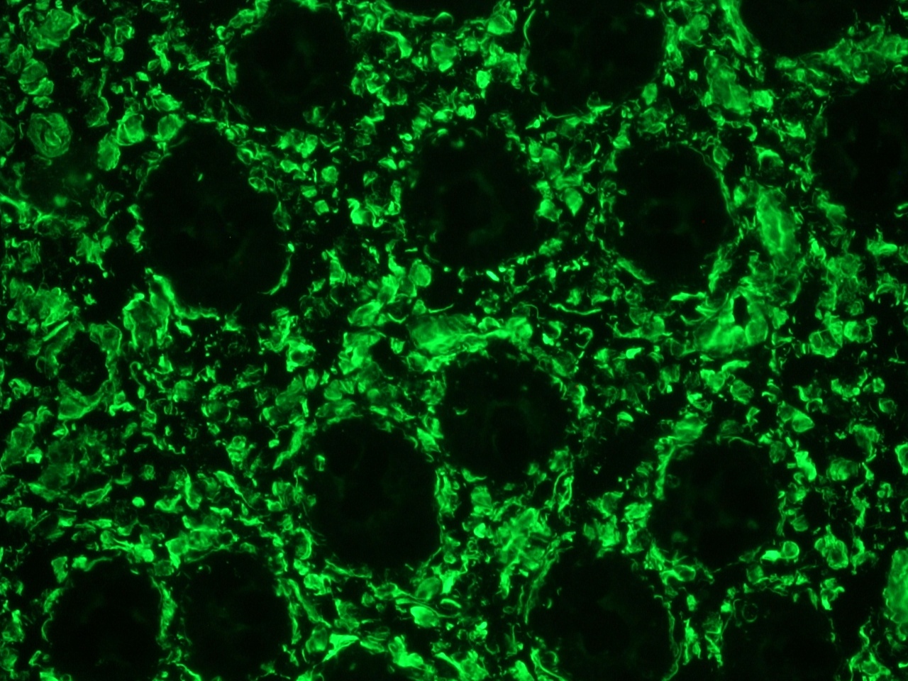 Immunofluorescence staining of frozen section of human colon using MUB1900L1. Note reactivity in connective tissue while epithelial cells remain negative.